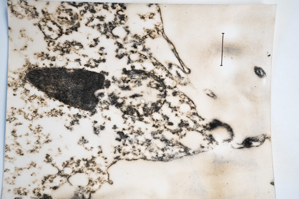 photo Argentique	France	Microscopique  SCIENTIFIQUE 17X23cm	1960